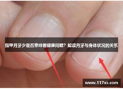 指甲月牙少是否意味着健康问题？解读月牙与身体状况的关系